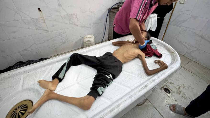 Gazze'de açlık nedeniyle toplu ölümler başladı