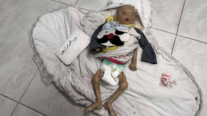 Gazze'de açlıktan ölümler sürüyor