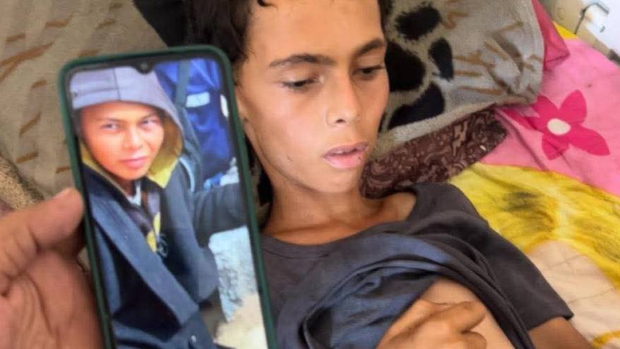 Gazze'de açlıktan ölümler her geçen gün artıyor