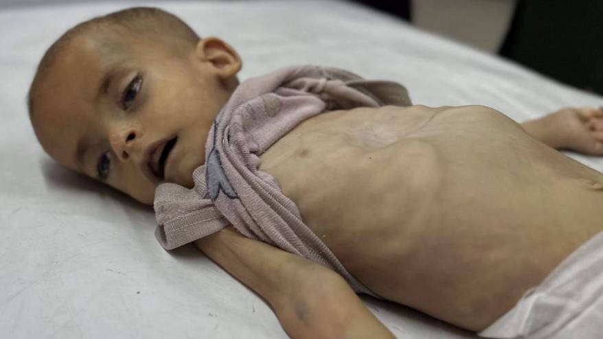 Gazze'de açlıktan ölenlerin sayısı 197'ye yükseldi