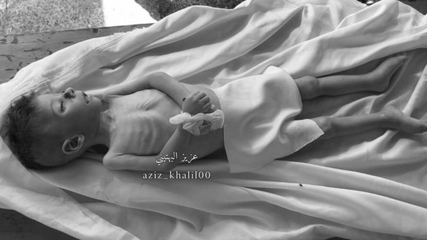 Gazze'de açlıktan ölenlerin sayısı 101'i çocuk 222'ye yükseldi