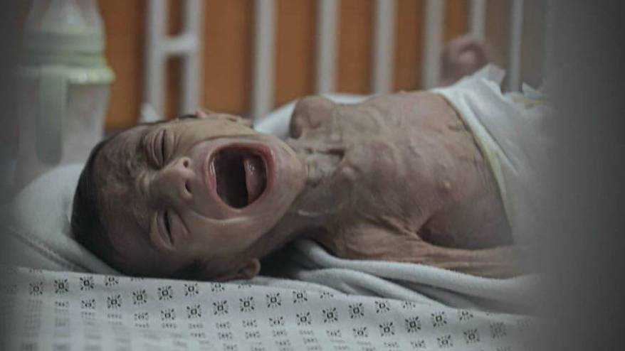 Gazze'de 24 saatte 3'ü çocuk 10 kişi açlıktan öldü