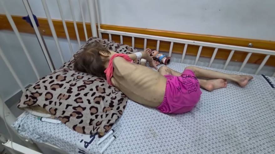 Gazze'de 121'i çocuk 317 kişi açlıktan öldü