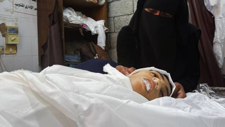 Gazze'de açlıktan can verenlerin sayısı 127'si çocuk 348'e ulaştı