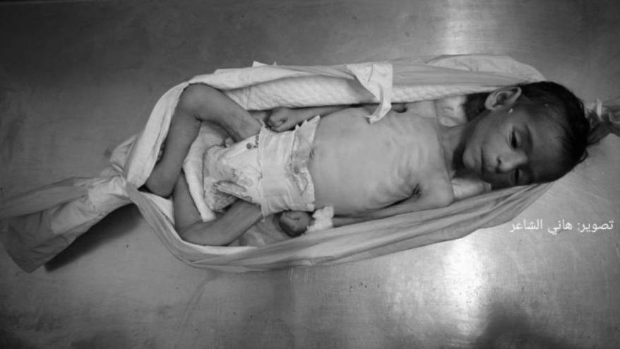 Gazze'de açlıktan ölenlerin sayısı 146'sı çocuk 428'e yükseldi